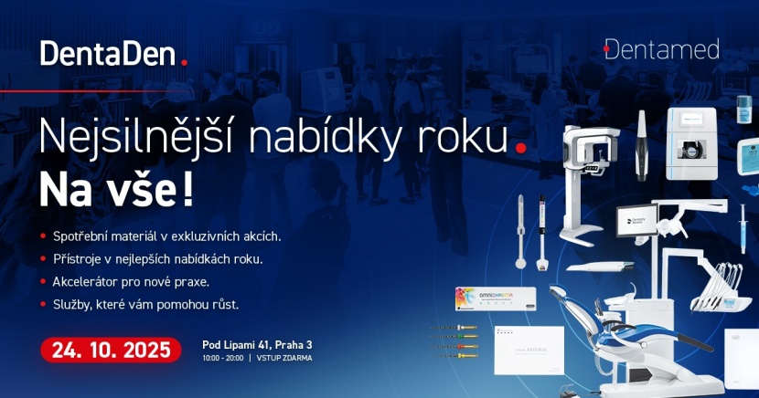 Zhotovení modelu