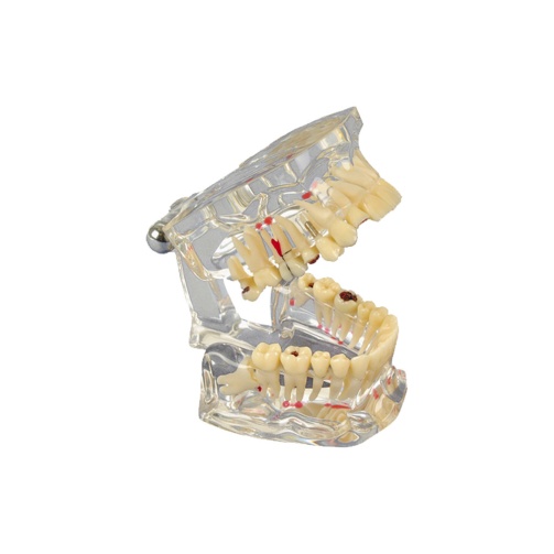 Model chrupu Transparent De Luxe