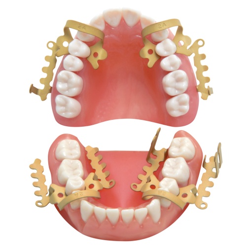 Neue Hallerklammer set 4ks gold